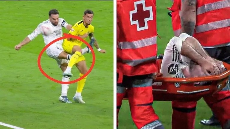 dani-carvajal-s-injury-1728214509881-16_9_11zon.jpg