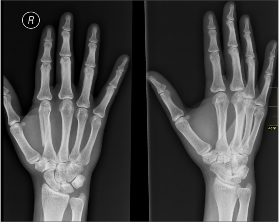 Medical_X-Ray_imaging_FKJ04_nevit.jpg