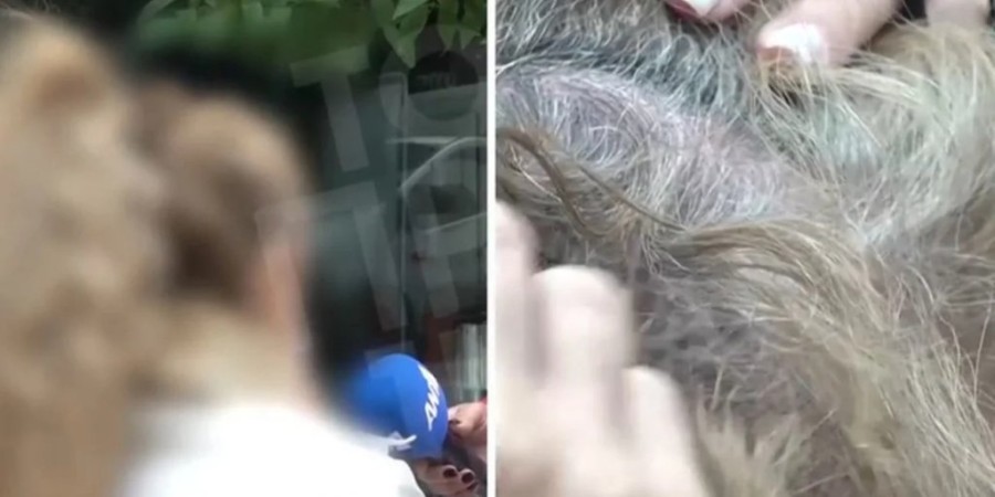 dafni-thima-xilodarmou-plastikos-xeirourgos.jpg_11zon (1).jpg