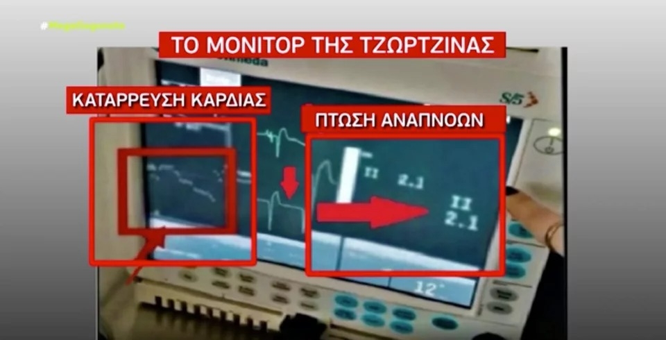 monitorkardias